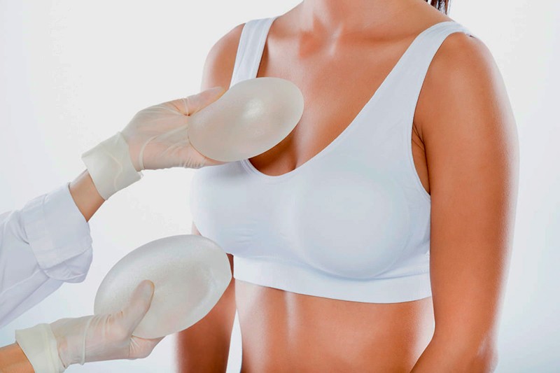 Imagem ilustrativa de Cirurgia plástica mamoplastia de aumento